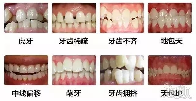 https://img.miyanlife.com/mnt/timg/180810/123F1HH-3.jpg