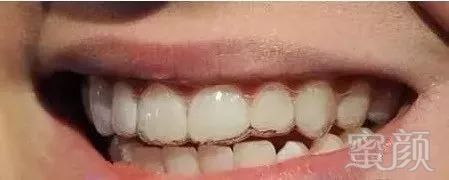 https://img.miyanlife.com/mnt/timg/180810/123FA363-9.jpg