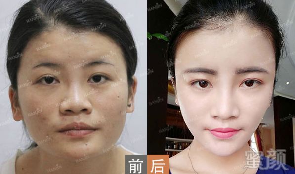 https://img.miyanlife.com/mnt/timg/180810/12504GN5-13.jpg