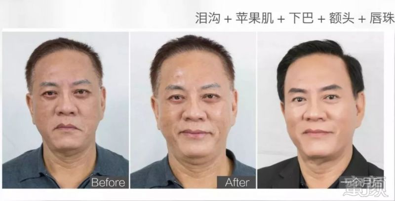 https://img.miyanlife.com/mnt/timg/180811/10291A240-10.jpg