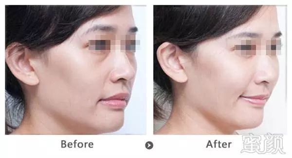 https://img.miyanlife.com/mnt/timg/180811/10291M101-12.jpg