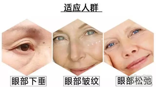 https://img.miyanlife.com/mnt/timg/180811/1045194414-6.jpg