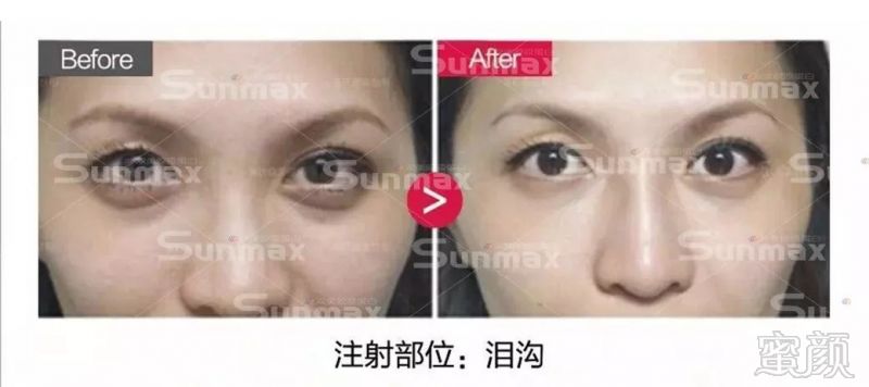 https://img.miyanlife.com/mnt/timg/180811/11004Q363-12.jpg