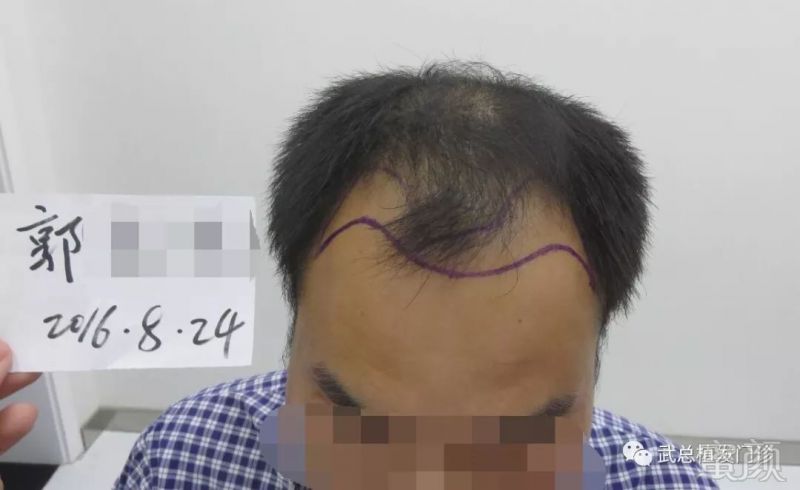 https://img.miyanlife.com/mnt/timg/180811/1109133339-0.jpg