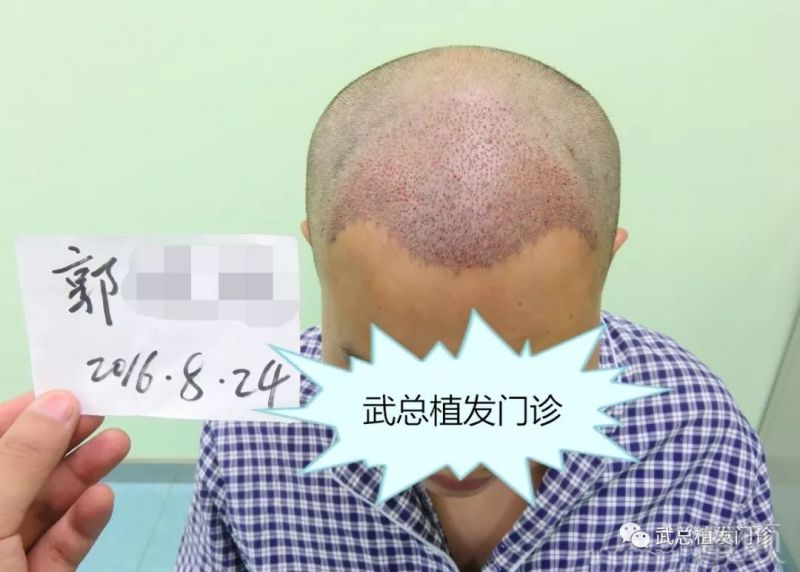 https://img.miyanlife.com/mnt/timg/180811/11091414X-1.jpg