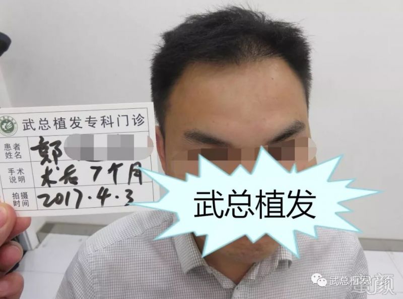 https://img.miyanlife.com/mnt/timg/180811/1109141W7-2.jpg