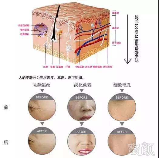 案例图片