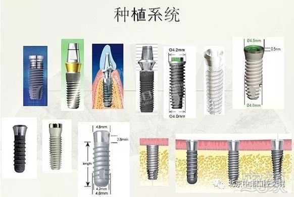 https://img.miyanlife.com/mnt/timg/180811/112610C26-2.jpg