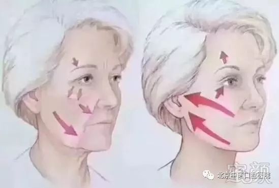 https://img.miyanlife.com/mnt/timg/180811/1126114045-3.jpg