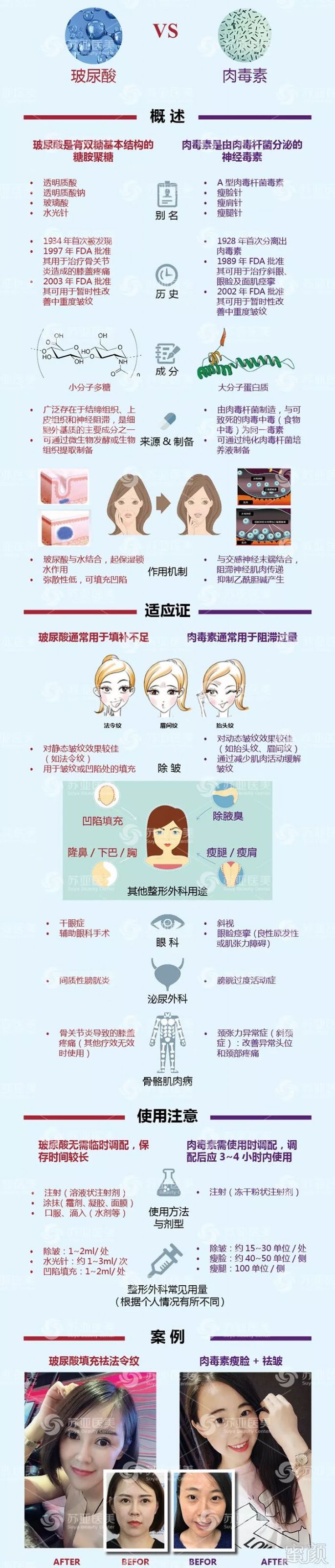 https://img.miyanlife.com/mnt/timg/180811/1151311412-1.jpg