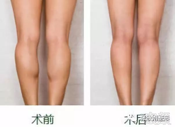 https://img.miyanlife.com/mnt/timg/180811/1216434953-2.jpg