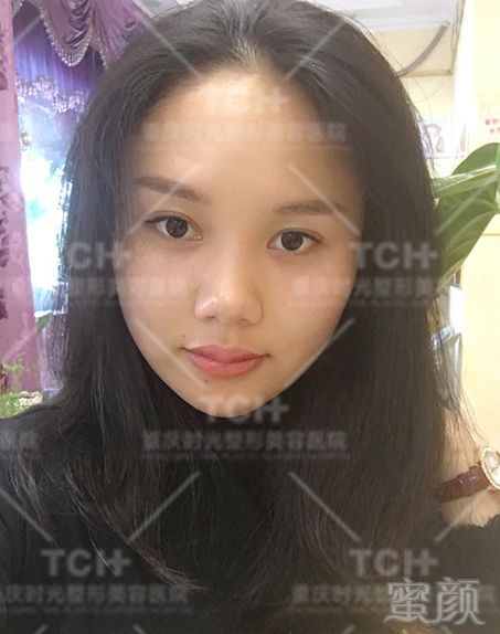 https://img.miyanlife.com/mnt/timg/180812/1122233139-10.jpg