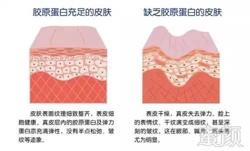 https://img.miyanlife.com/mnt/timg/180812/1153251X2-7.jpg