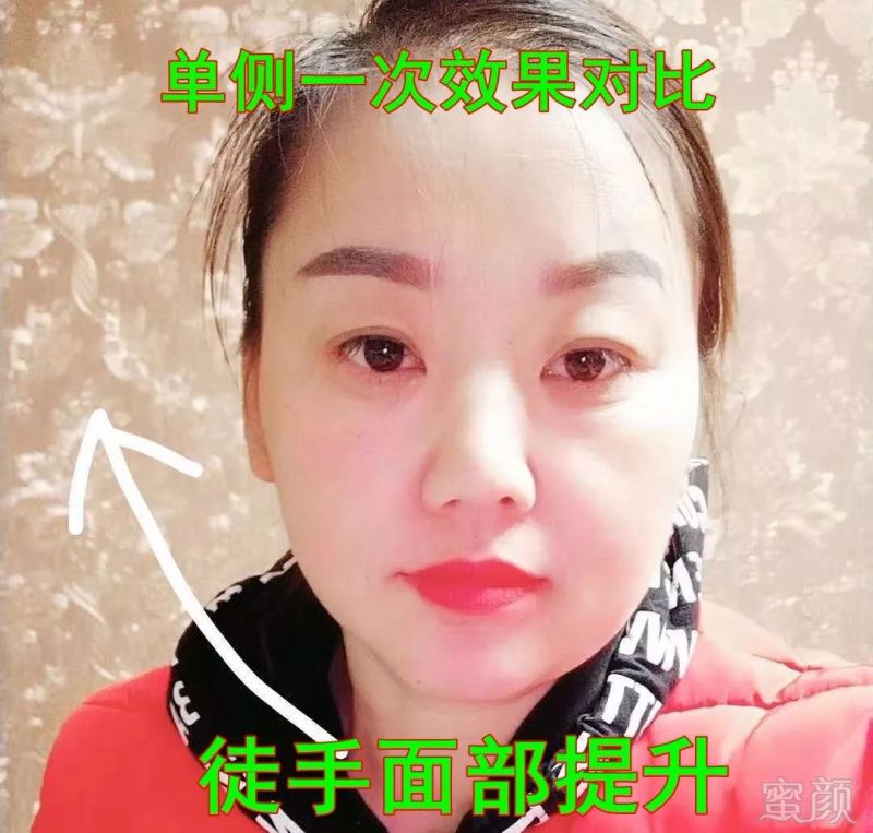 https://img.miyanlife.com/mnt/timg/180812/130F63Z2-9.jpg