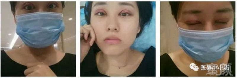 https://img.miyanlife.com/mnt/timg/180812/1331294521-1.jpg