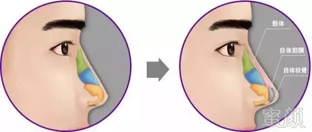 https://img.miyanlife.com/mnt/timg/180812/141A12925-4.jpg