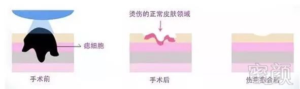 案例图片