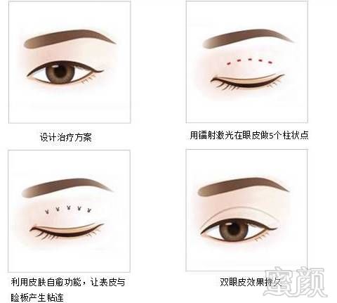 https://img.miyanlife.com/mnt/timg/180812/15012G3G-4.jpg