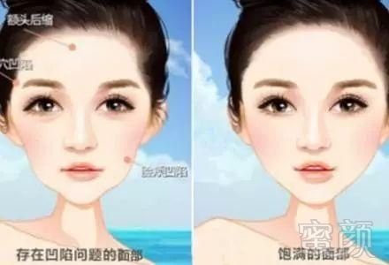 https://img.miyanlife.com/mnt/timg/180813/1044525501-5.jpg