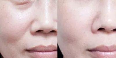 https://img.miyanlife.com/mnt/timg/180813/1044532Z0-6.jpg