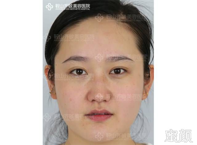 https://img.miyanlife.com/mnt/timg/180813/110T0C17-1.jpg