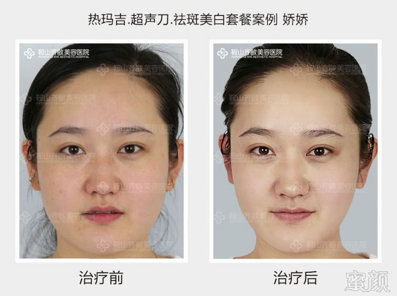 https://img.miyanlife.com/mnt/timg/180813/110T12335-4.jpg
