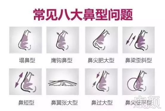 https://img.miyanlife.com/mnt/timg/180813/1202451538-1.jpg