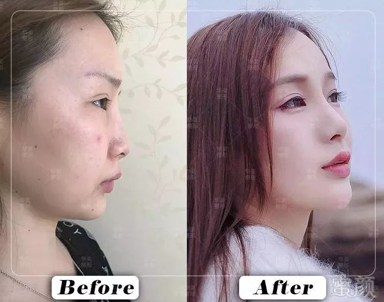 https://img.miyanlife.com/mnt/timg/180813/1202491061-10.jpg