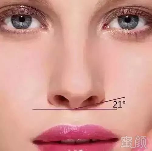 https://img.miyanlife.com/mnt/timg/180813/12024Q162-8.jpg