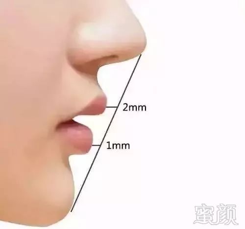 https://img.miyanlife.com/mnt/timg/180813/12024Q4T-5.jpg