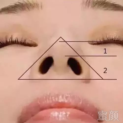 https://img.miyanlife.com/mnt/timg/180813/12024RH7-7.jpg