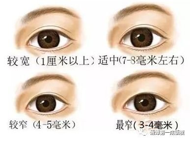 https://img.miyanlife.com/mnt/timg/180813/12035M610-1.jpg