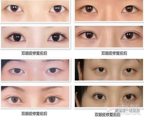 https://img.miyanlife.com/mnt/timg/180813/12035W091-3.jpg