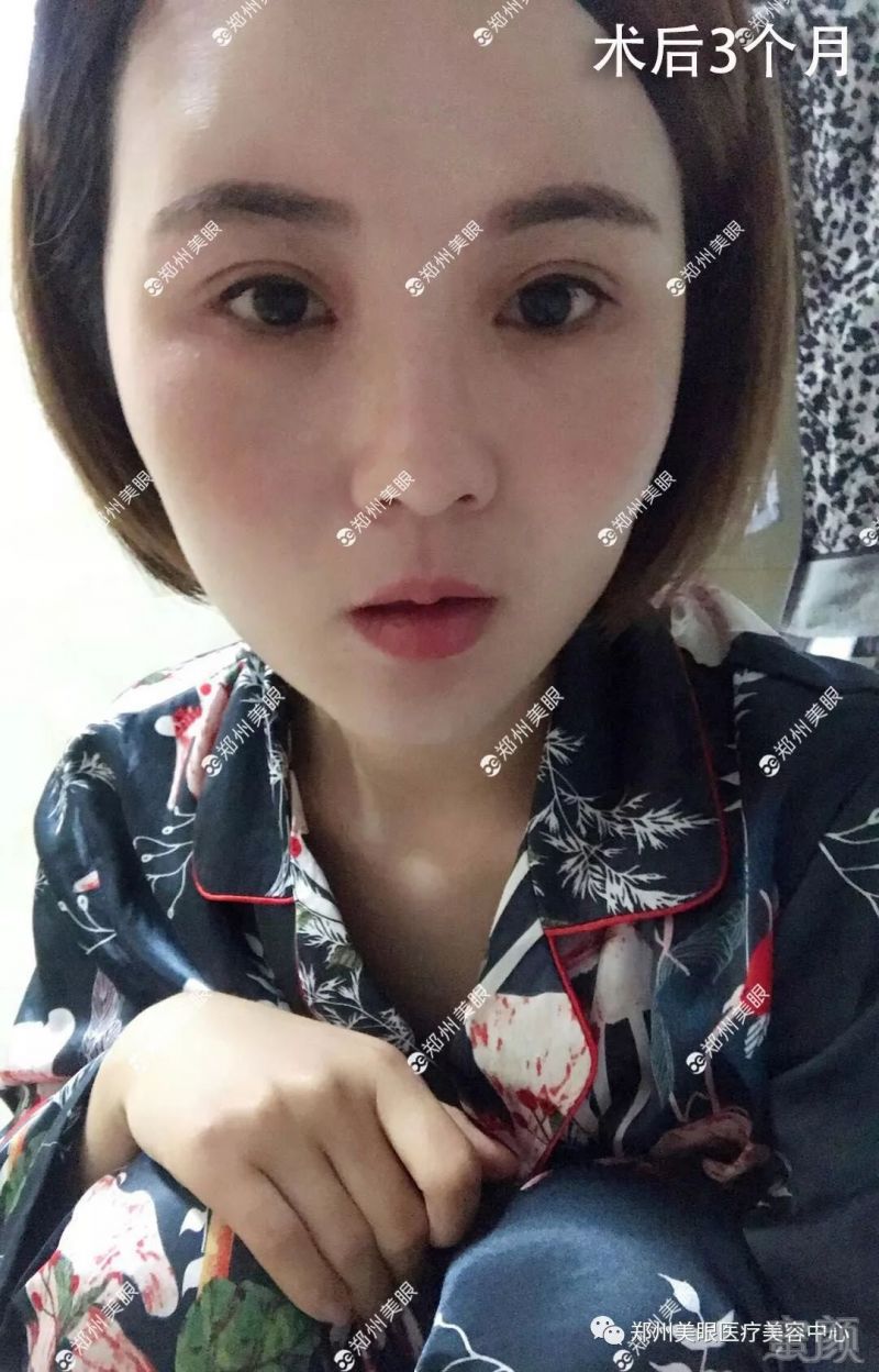 https://img.miyanlife.com/mnt/timg/180813/123A64J9-2.jpg