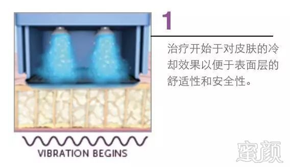 https://img.miyanlife.com/mnt/timg/180814/121I21346-0.jpg