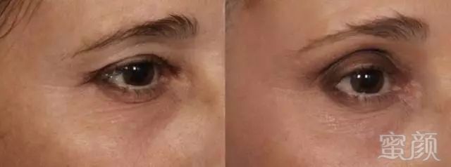https://img.miyanlife.com/mnt/timg/180814/121I32201-4.jpg