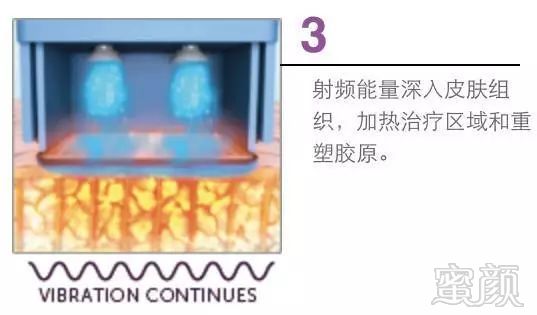 https://img.miyanlife.com/mnt/timg/180814/121I33593-2.jpg