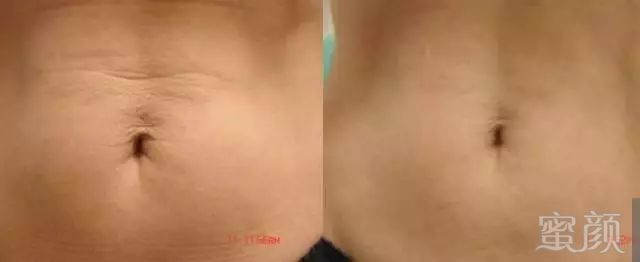 https://img.miyanlife.com/mnt/timg/180814/121I45U8-6.jpg