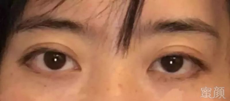 https://img.miyanlife.com/mnt/timg/180814/121P11559-0.jpg