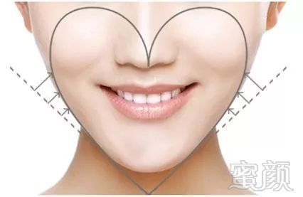https://img.miyanlife.com/mnt/timg/180814/12245LT6-1.jpg