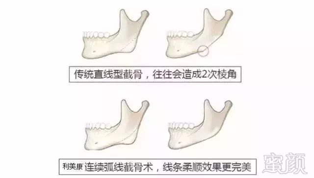 案例图片