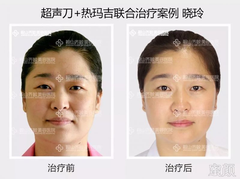 https://img.miyanlife.com/mnt/timg/180815/115T62Y9-5.jpg