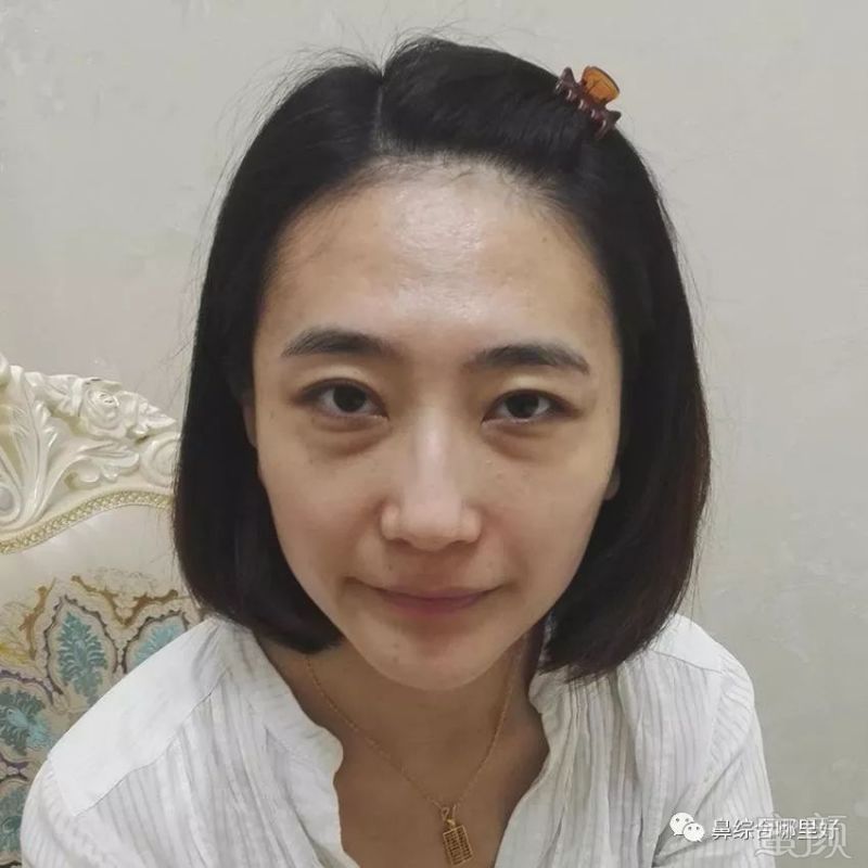 https://img.miyanlife.com/mnt/timg/180815/120Z223H-0.jpg