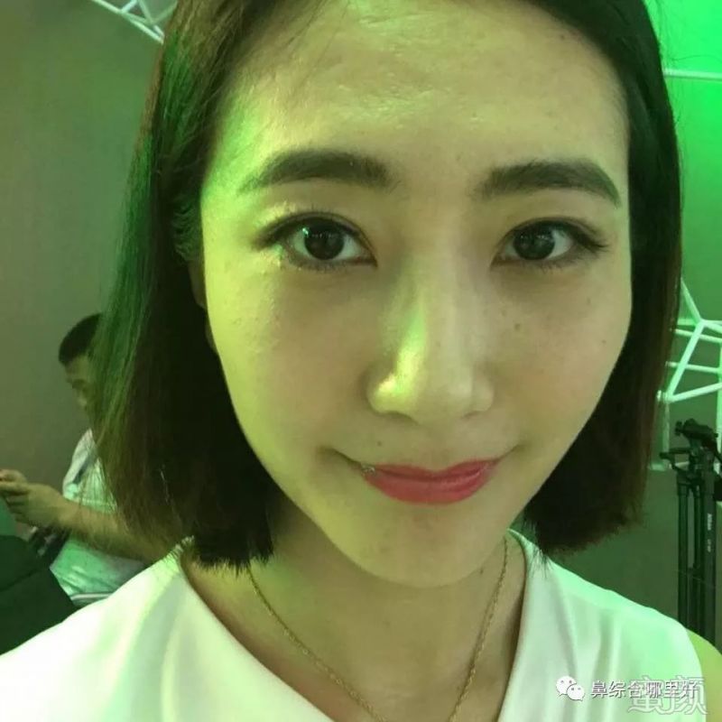 https://img.miyanlife.com/mnt/timg/180815/120Z343G-2.jpg