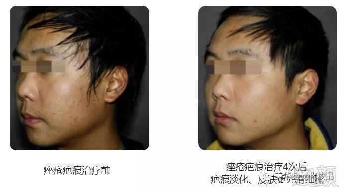 https://img.miyanlife.com/mnt/timg/180815/1221495F4-9.jpg
