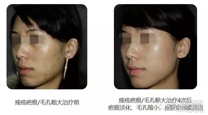 https://img.miyanlife.com/mnt/timg/180815/122149D58-8.jpg