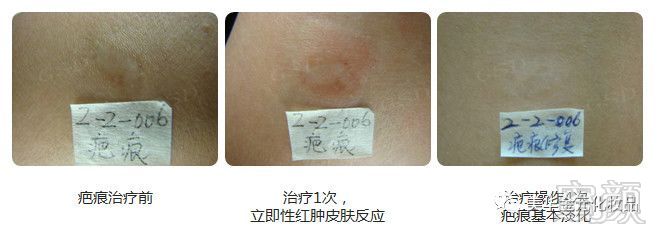 https://img.miyanlife.com/mnt/timg/180815/12214V048-4.jpg