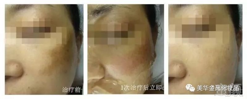 https://img.miyanlife.com/mnt/timg/180815/122150M64-10.jpg