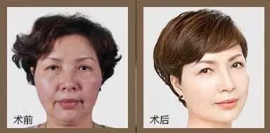 https://img.miyanlife.com/mnt/timg/180815/12261a020-1.jpg