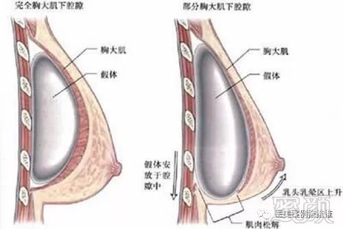 案例图片